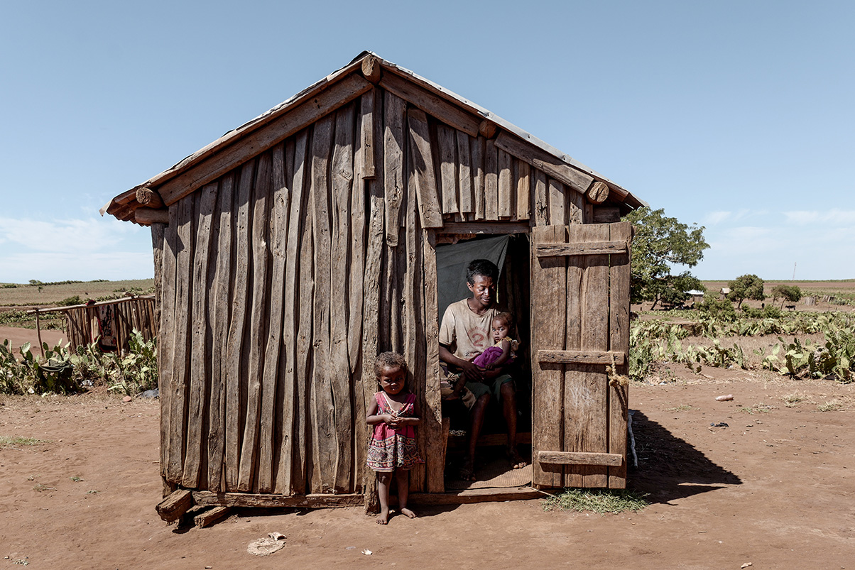 In a neighbouring village, Maho, 21 months also suffers from severe acute malnutrition. The little girl waits with her father for her mother to return from fetching water from a distant well.